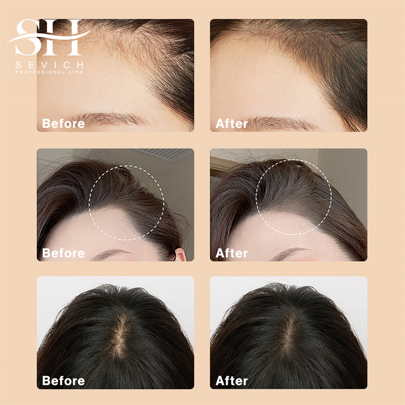 مسحوق ظلال العيون من شعري، غطا - مراجعة Rooting Hormone Powder وسعره